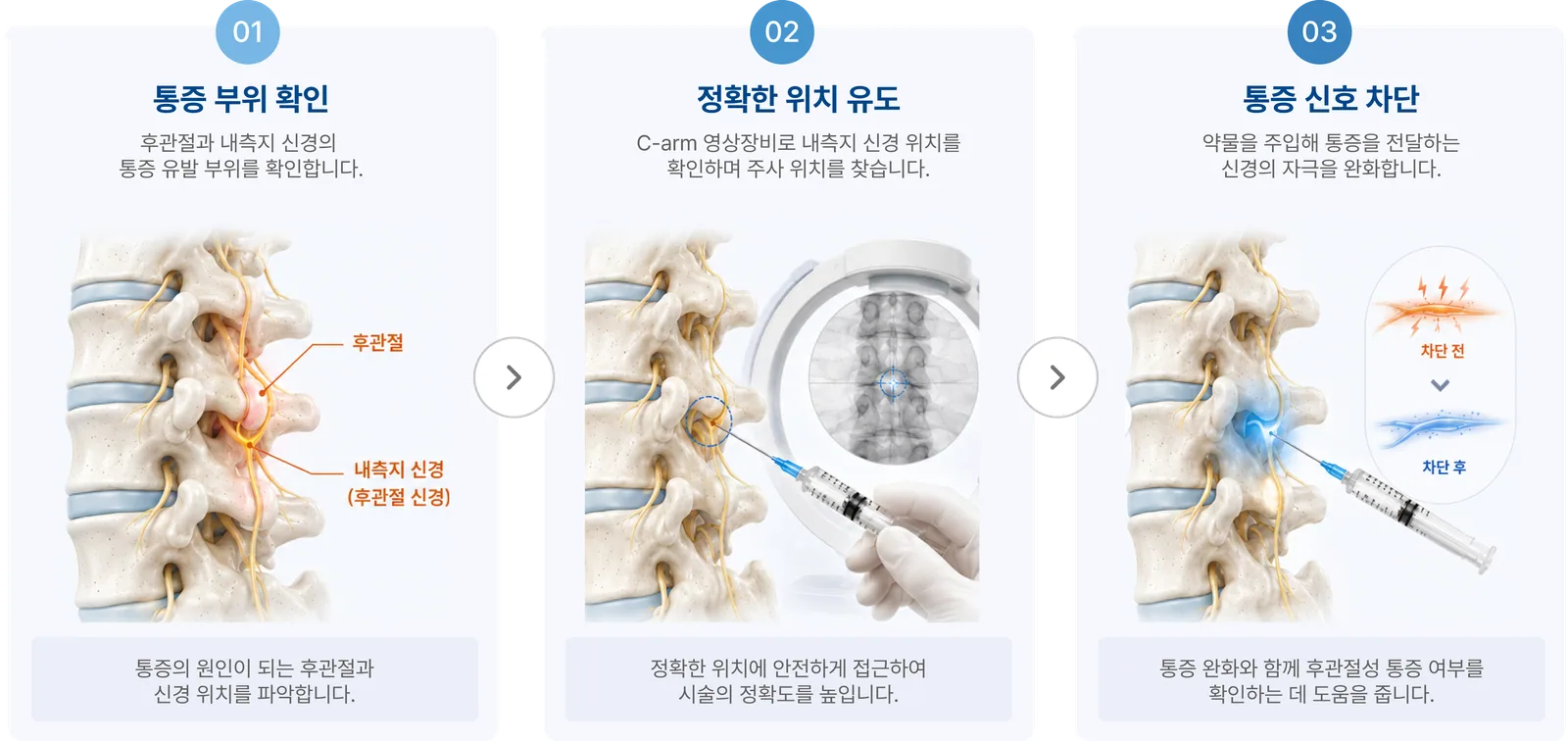 시술 과정 3단계: 01 통증 부위 확인, 02 정확한 위치 유도, 03 통증 신호 차단