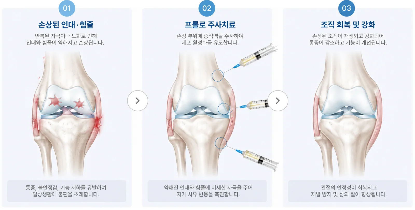 치료 방법 3단계: 01 손상된 인대·힘줄, 02 프롤로 주사치료, 03 조직 회복 및 강화